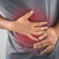 Beberapa Penyebab Sakit Perut Sebelah Kiri Yang Perlu Diwaspadai