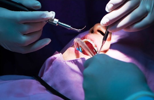 Mengenal Scaling Gigi Pentingnya Perawatan Profesional untuk Kesehatan Gigi dan Gusi